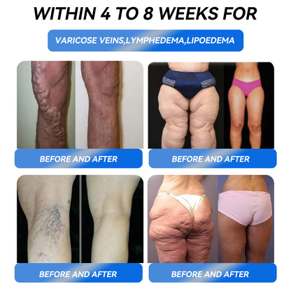 IFMAGIC® 🌲GLP-1 Pro Weight Loss Oral Solution7 days visible effect, no side effects, suitable for all age groups